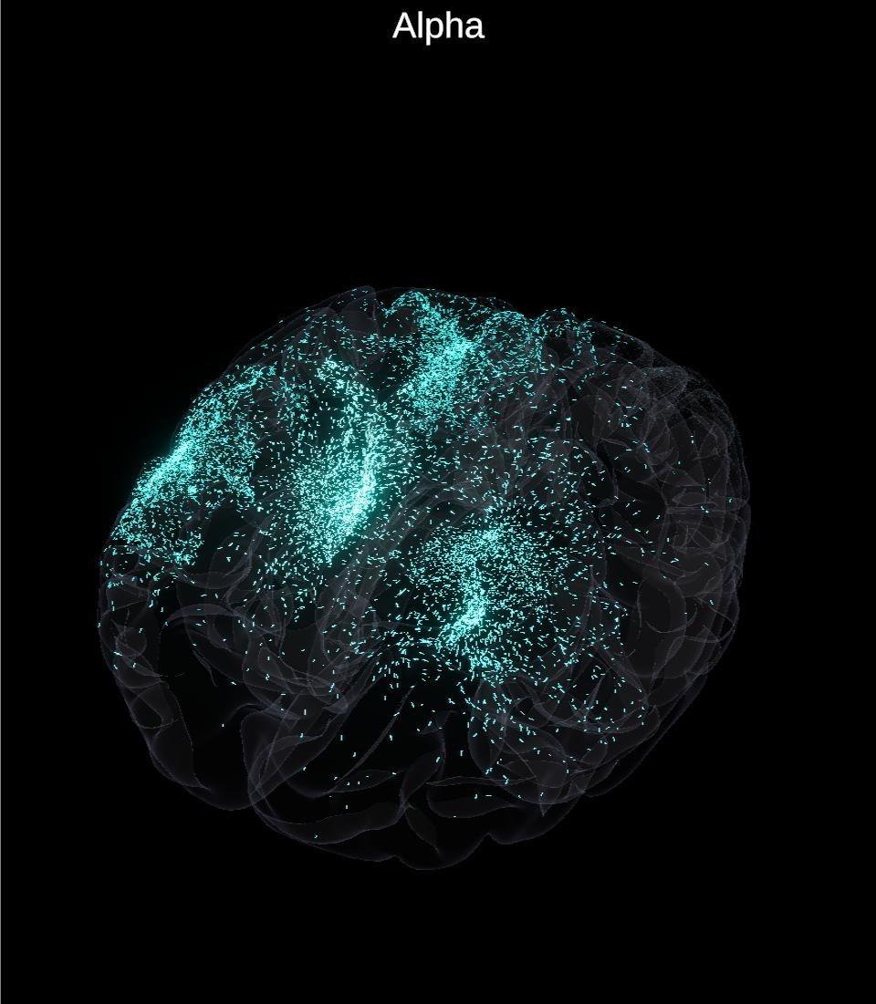 A qEEG brain-activity map
